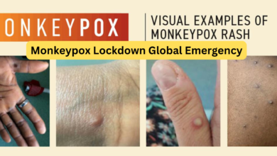 Monkeypox Lockdown